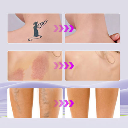 💜Begrenzter Verkauf: KAUFEN SIE 1 UND ERHALTEN SIE 1 GRATIS!! 💜All-in-One-Feuchtigkeitscreme, Concealer und Deckkraft Perfector